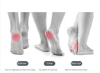 Flawless Pedi Foot Pedicure & Callus Remover