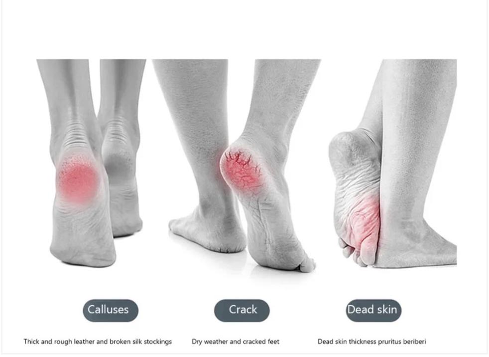 Flawless Pedi Foot Pedicure & Callus Remover